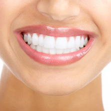 Veneers My Dentist Brookline