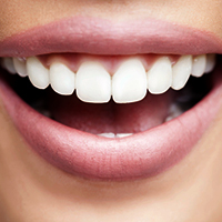 teeth whitening dr. lozada